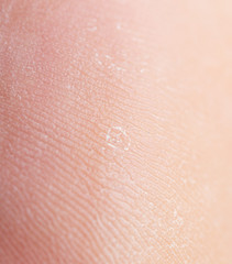 Background of human skin macro