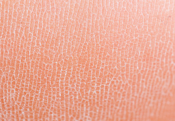 Background of human skin macro