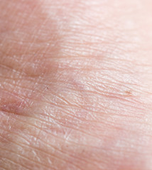 Background of human skin macro