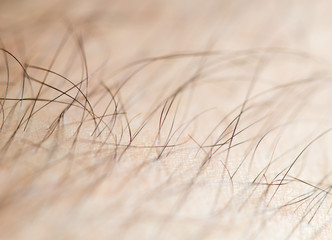Hair on the body of the macro