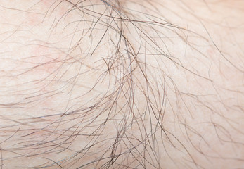 Hair on the body of the macro