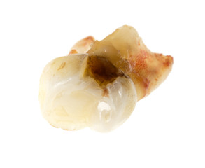 children's tooth on a white background