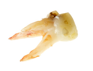 Fototapeta premium children's tooth on a white background