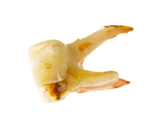 children's tooth on a white background