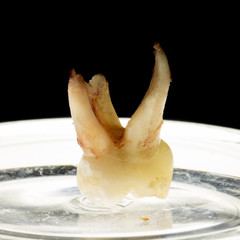 children's tooth on a black background
