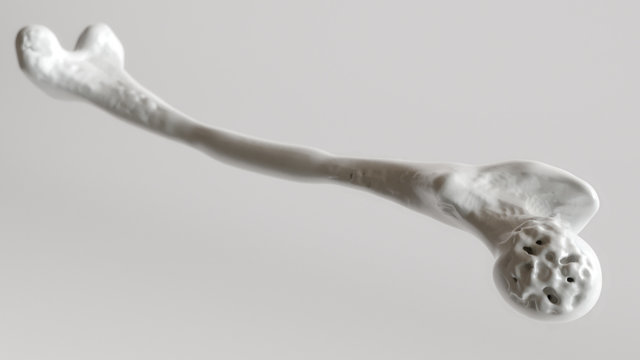 Osteoporosis stage 2 of 4 - upper limb bones - 3d rendering
