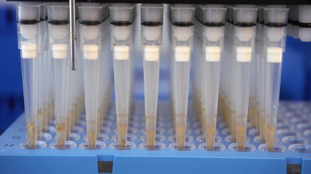Automatic analysis of DNA. Automation in the clinical laboratory. Pipetting robot laboratory. Medicine robotics. NGS DNA diagnostics. Research and science background