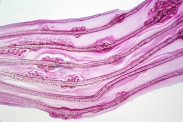 Eggs liver fluke(Parasitic flatworm) infection in fish fin.