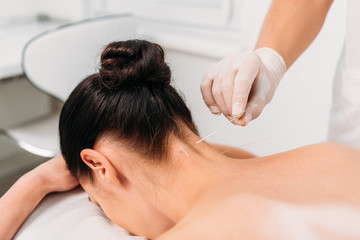 cropped shot of cosmetologist putting needles on womans body during acupuncture therapy in spa salon