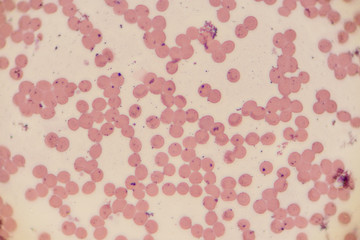 Study of white blood cells are the cells of the immune system under the microscope in laboratories.