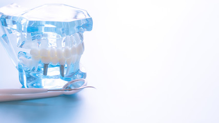 Dental model in oral health care concept.