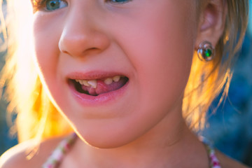 Portrait of a little girl with an outstretched milk tooth