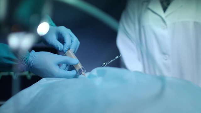 Surgeon hands pouring blood in syringe at surgical procedure. Close up of medical hands sampling blood of patient during procedure. Medical operation. Blood sampling at surgeon room
