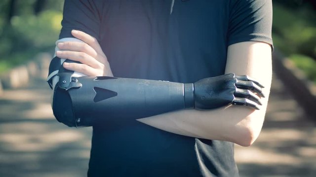 A man is crossing his artificial arm with a healthy one. Human cyborg concept.