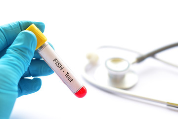 Naklejka premium Blood sample for fluorescence in situ hybridization or FISH test, laboratory method for chromosome study 
