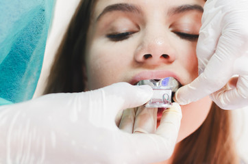 Dentist taking print with mold