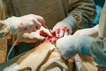 surgeons make seams in the wound area of the patient and use medical instruments in the operating...