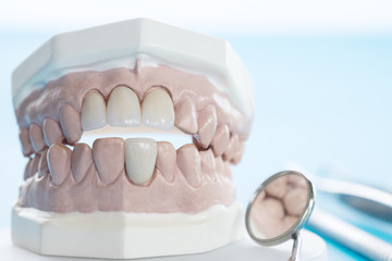 Fototapeta na wymiar porsthodontic model and dentist tool - demonstration teeth model of varities of porsthodontic bracket or brace