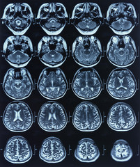 brain x ray images