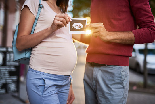 We are sharing happiness with you. Cropped portrait of young pregnant woman and her husband demonstrating sonogram photo of their future child. Couple standing on sunny street