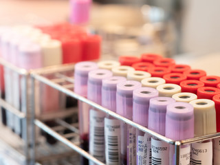 plastic laboratory tubes prepared in lab centrifuge machine blood bank. blood test