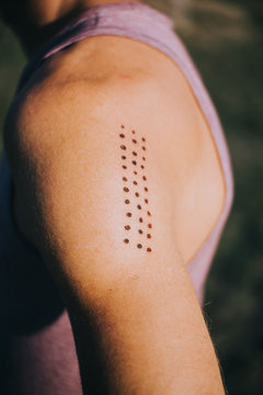 close-up of a man's arm with Kambo ceremony burning marks