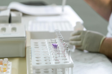 Laboratory equipment for blood analysis. The real work of the laboratory assistant in the hospital.
