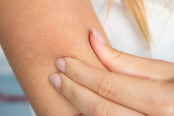 Wrinkles in dry skin of arm close up