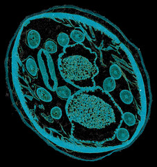 ascaris - cross section cut under the microscope – microscopic view of animal cells for education