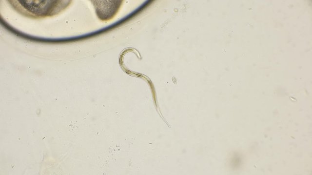 the nematode worm under a microscope