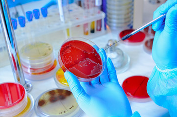 Petri dish. Microbiological laboratory. Mold and fungal cultures. Bacterial research