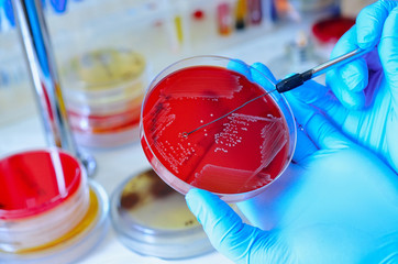 Petri dish. Microbiological laboratory. Mold and fungal cultures. Bacterial research