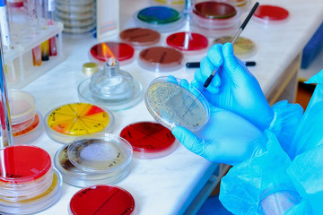Petri dish. Microbiological laboratory. Mold and fungal cultures. Bacterial research