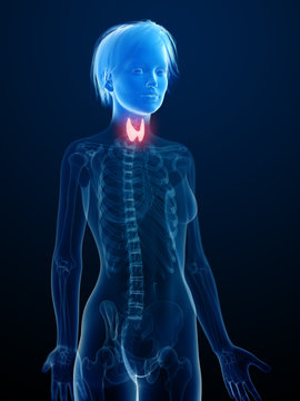 3d rendered medically accurate illustration of an inflamed thyroid gland