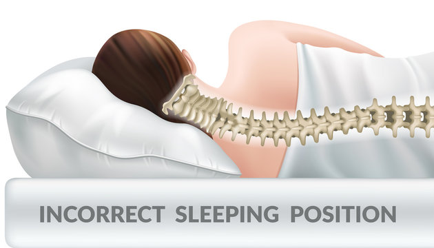 Incorrect posture for sleep on a regular pillow. Wrong position cervical vertebrae. Spinal curvature. 3d realistic vector illustration.