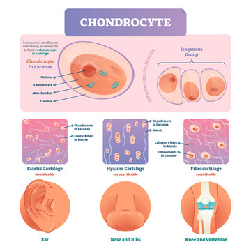 Chondrocyte vector illustration infographic. Medical labeled biology diagram
