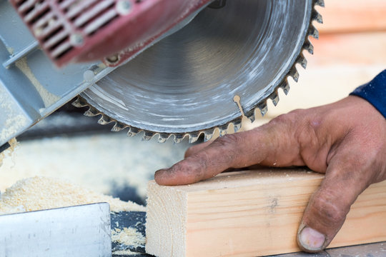 Injury when working with a saw. Place for your text.