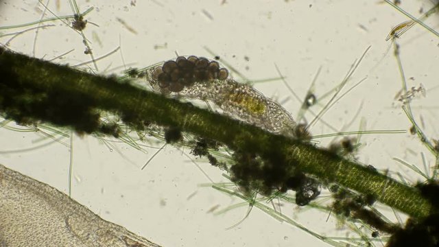 female bear Tardigrada with eggs under a microscope