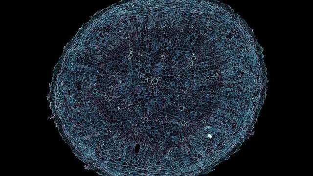 plasmodiophora brassicae root - cross section cut under the microscope &ndash; microscopic view of plant cells for botanic education