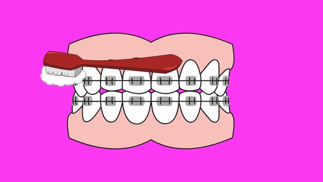 Dental Care - Vector Animation
