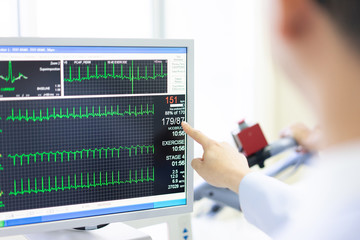 The doctor check heart rate and pulse of patient by running test for protect the heart attack.
