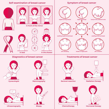 Breast cancer set. Self-examination, symptoms, diagnostics, treatments. Medicine, pathology, anatomy, physiology, health. Info-graphic. Vector illustration. Healthcare poster or banner template.
