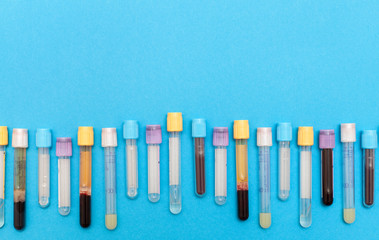 Blood samples in a rack. close-up medicine test tubes blood for blue background. Flat lay, top view. Hematology blood analysis report with colorful sample collection tubes with space for text