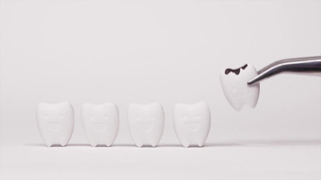 Pulling Decay tooth model among Good Teeth if don't brush the teeth every day, tooth will not unhealthy 