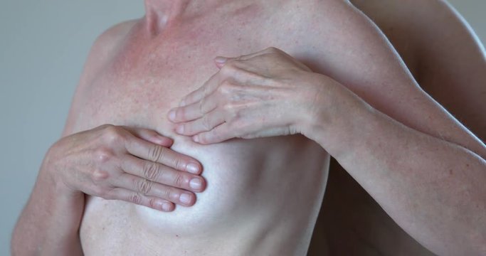 Woman Breast Self Examination with hand for lumps being possible cancer