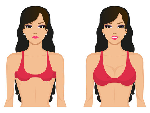 Vector illustration breasts before and after