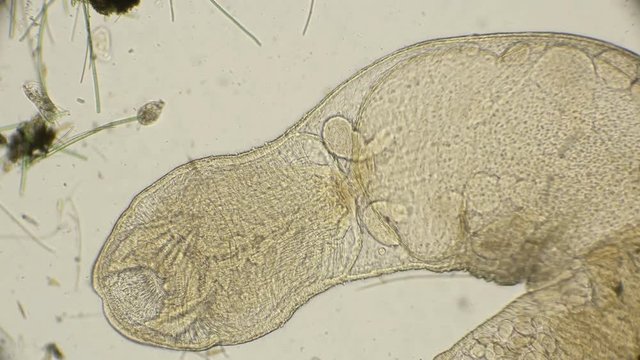 an oligochaete intestinal worm with a large open mouth in motion, under a microscope