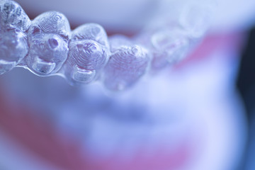 Invisible dental teeth aligners