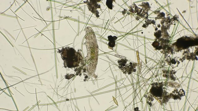 the most enduring organism on the planet is the thief, or the water bear Tardigrada, under a microscope