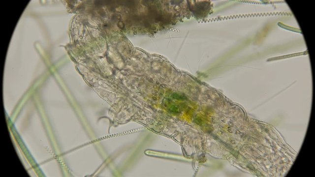 the most enduring organism on the planet is the thief, or the water bear Tardigrada, under a microscope